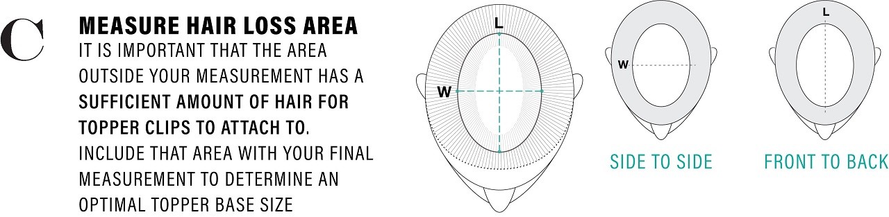 Infographic showing how to measure your area of hair loss.