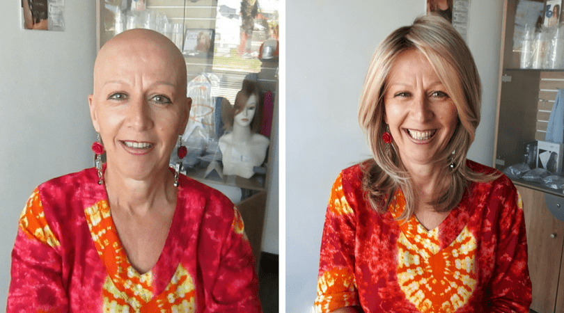Gail showing her hair loss before and after she wears a wig