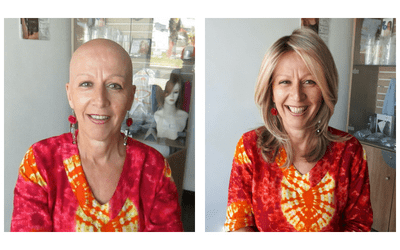 Gail’s Hair Loss Story and how she saved money wearing wigs