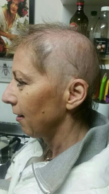 Gail's hair loss story with Fascinations hair in Cape Town
